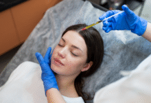 Is Slim FUE Transplant in Florida Right for Your Hair
