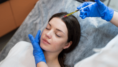 Is Slim FUE Transplant in Florida Right for Your Hair