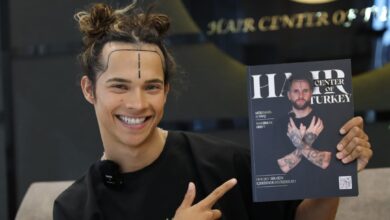 Hair Transplant Tourism on the Rise in Turkey