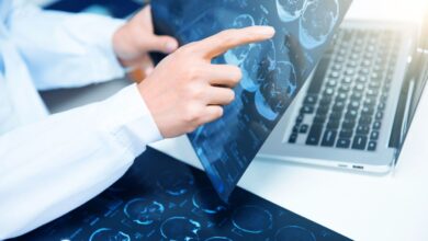 mri imaging