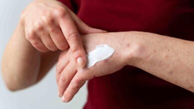 How to Choose the Right Eczema Cream for Your Skin Type and Needs