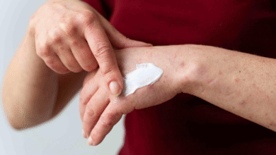 Right Eczema Cream