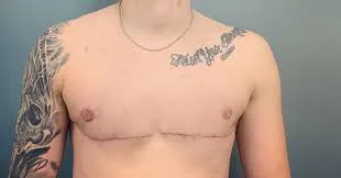 Surgery